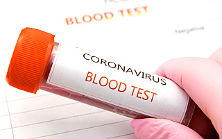 Ministerstwo zdrowia: przebadano 676 próbek na obecność koronawirusa, zero nowych zarażeń